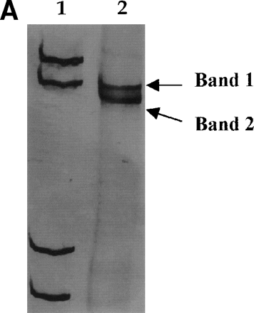 FIGURE 2a, Genomic Complexity of Hepatitis C Virus With Liver Disease Severity