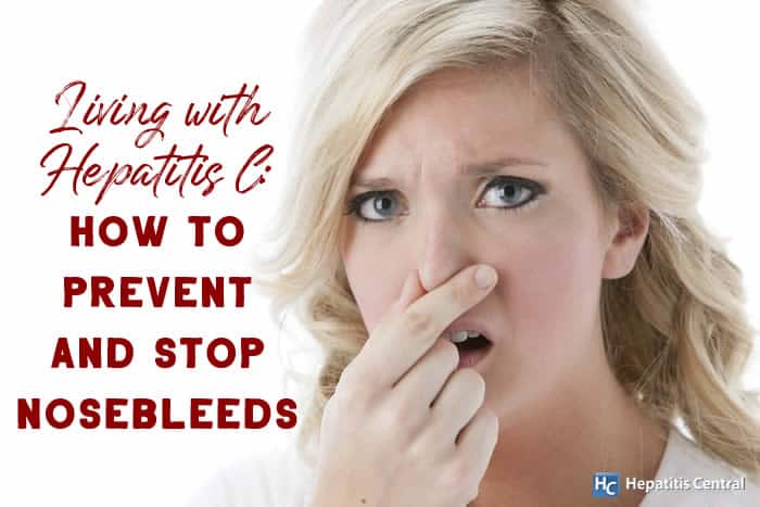 Living with Hepatitis C_How to Prevent and Stop Nosebleeds