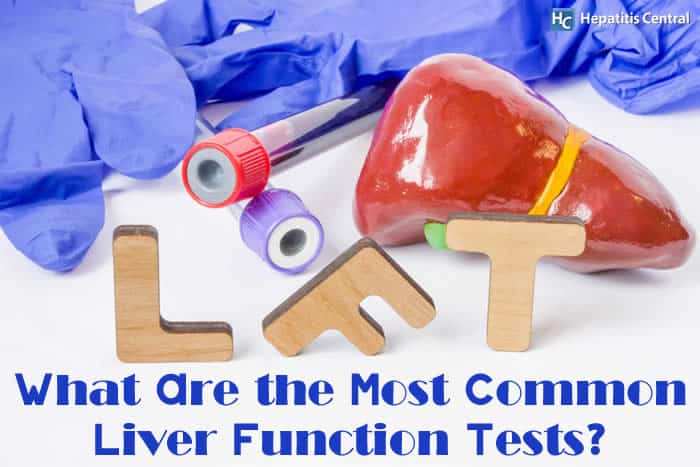 What Are the Most Common Liver Function Tests