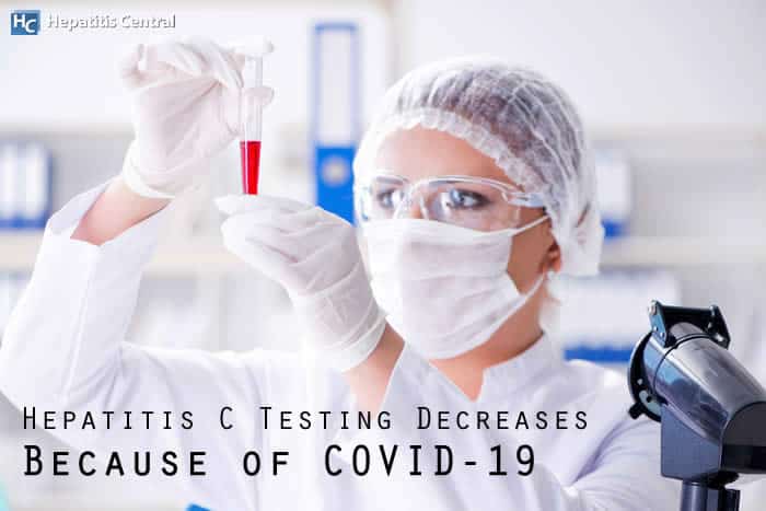 Hepatitis C Testing Decreases Because of COVID-19