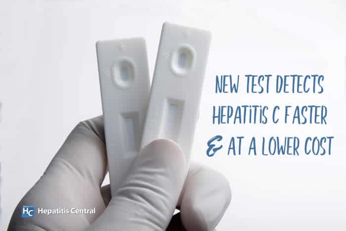 New Test Detects Hepatitis C Faster and at a Lower Cost