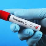 What Can You Do When Your Hepatitis C Treatment Doesn’t Work?