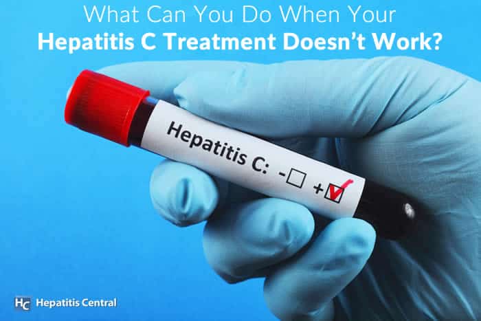 What Can You Do When Your Hepatitis C Treatment Doesn’t Work?