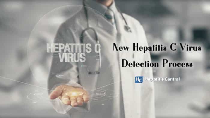 New Hepatitis C Virus Detection Process